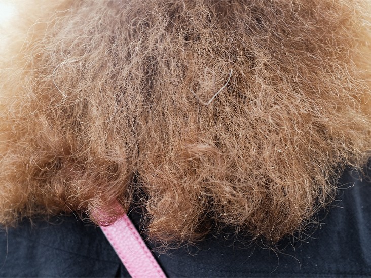 cabelo com a textura de palha pode ser uma preocupaca medica