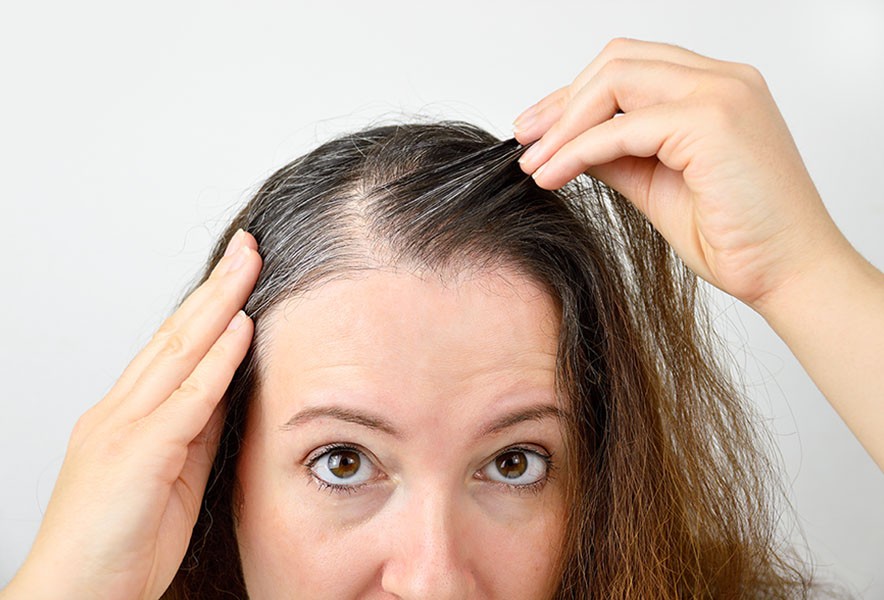 causas da queda de cabelo