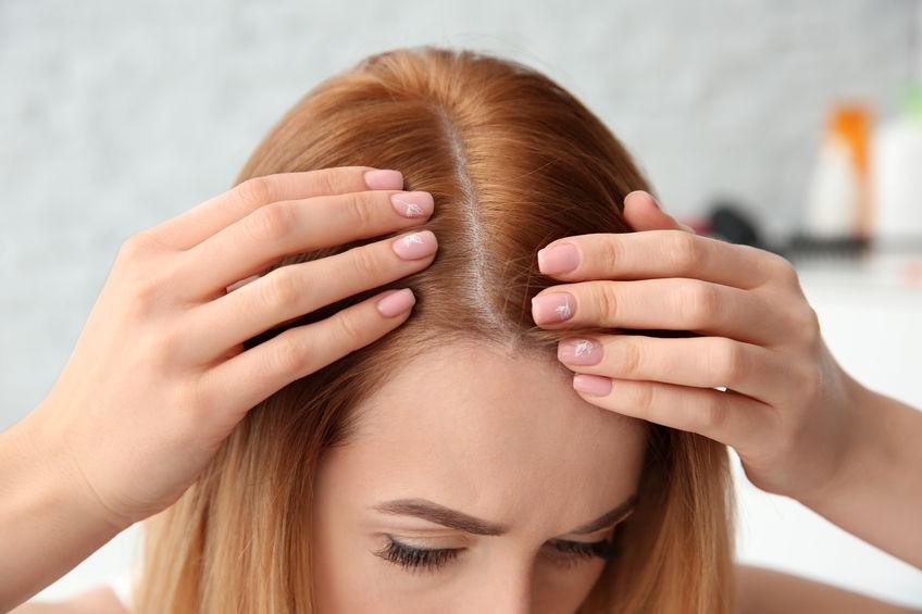 cha verde no cabelo ajuda tratar a queda de cabelo