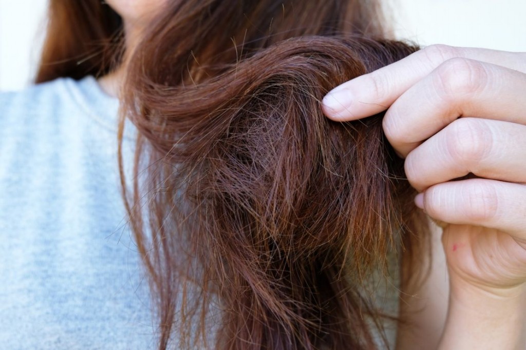 como prevenir e acabar com a queda de cabelo